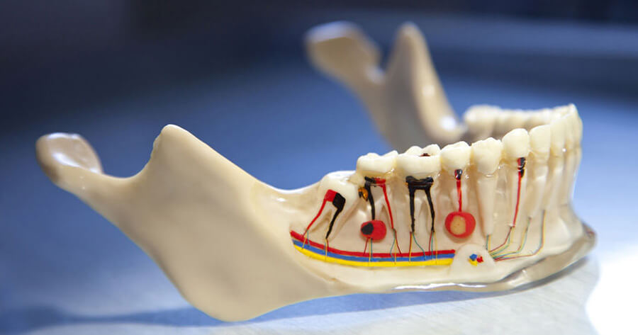 kanal tedavisi fiyatları