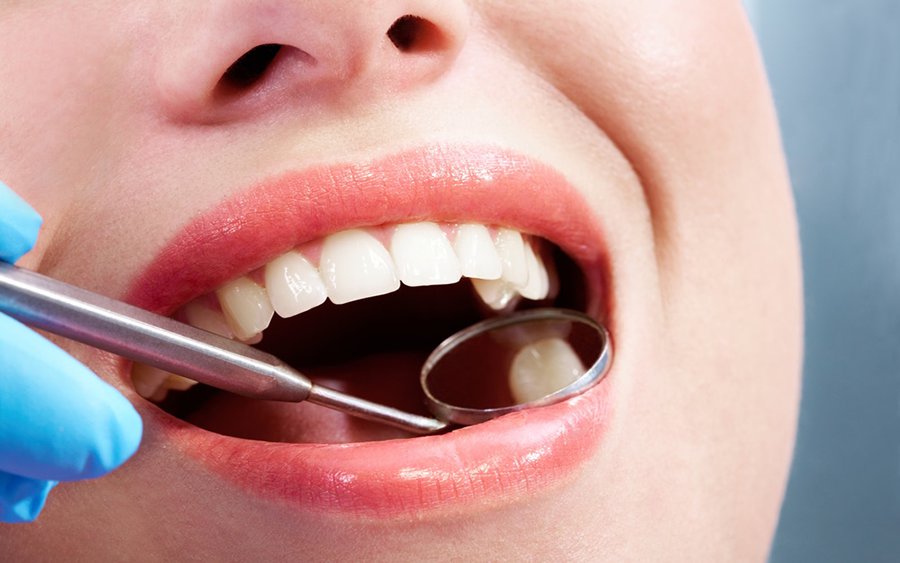 Ankara Endodonti Uzmanı