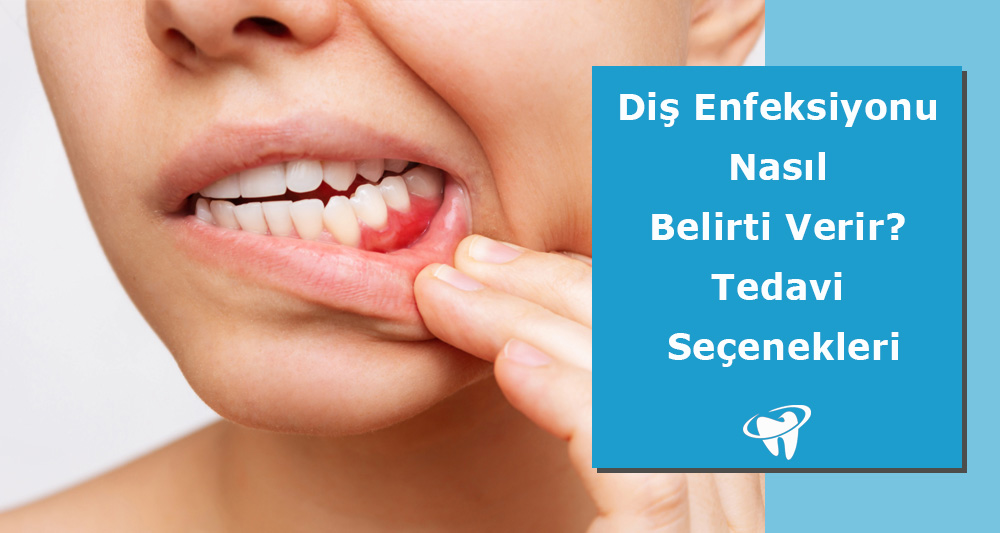 Diş Enfeksiyonu