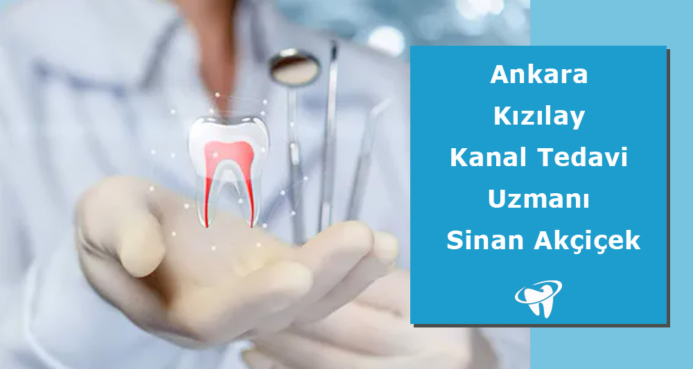 Ankara Kızılay Kanal Tedavi Uzmanı