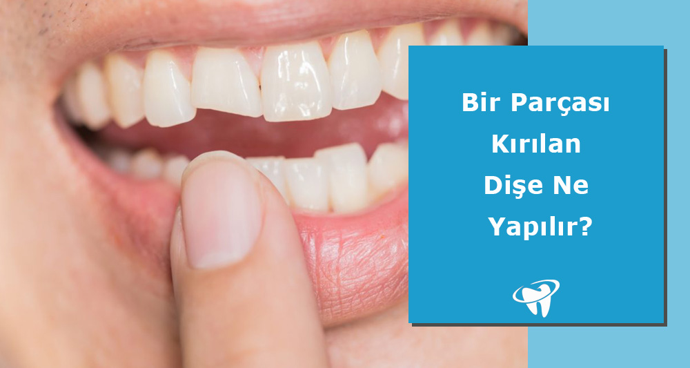 Kırılan Dişe Ne Yapılır?