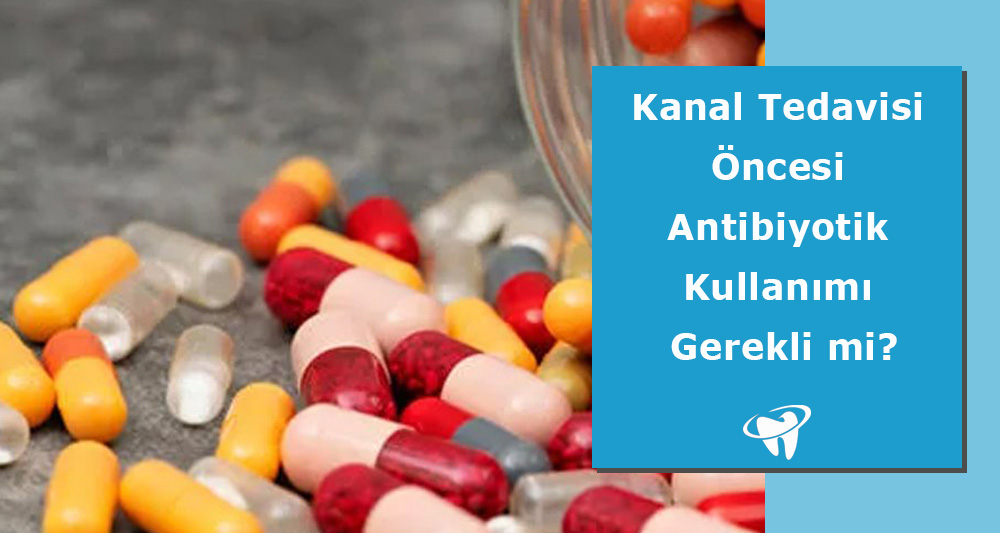 Kanal Tedavisi Öncesi Antibiyotik Kullanımı