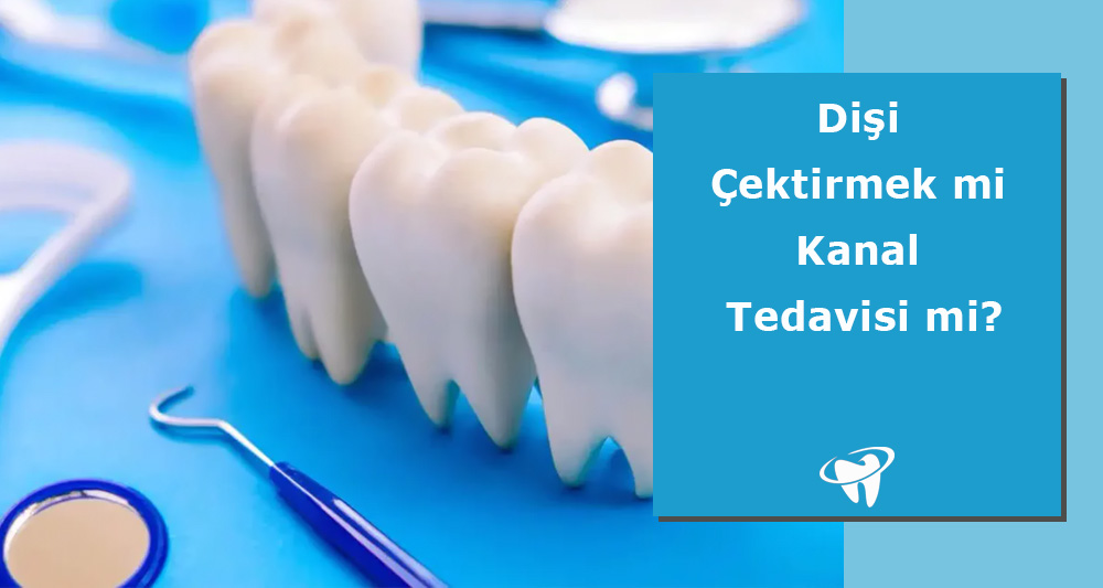 Dişi Çektirmek mi Kanal Tedavisi mi?
