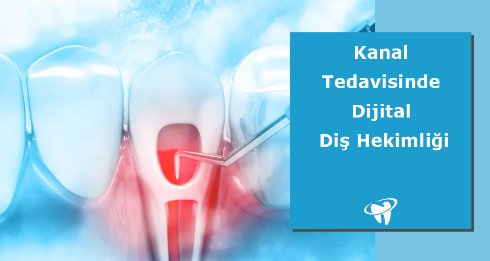 Kanal Tedavisinde Dijital Diş Hekimliği